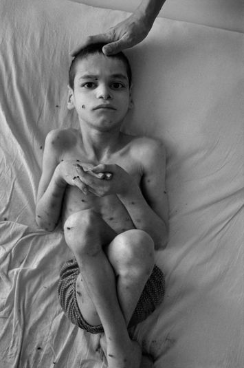 “Child of War,” Beirut, Lebanon